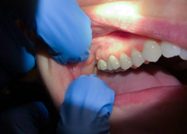 Best Pediatric Emergency Dentist in Spotsylnia Courthouse, VA